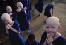 ​Albinos en Tanzanie, une vie de stigmatisation et de violence