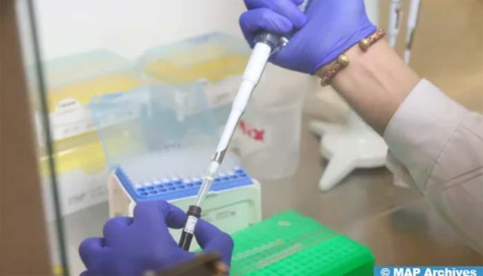 CDC-Afrique recommande le premier test PCR en temps réel pour la Mpox fabriqué localement au Maroc