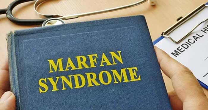 Le Syndrome de Marfan expliqué à Rabat