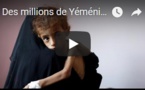 Des millions de Yéménites face à la famine (ONU)