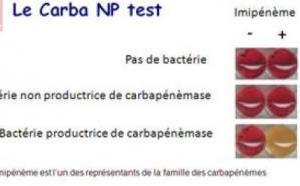 Deux tests rapides pour détecter les résistances aux antibiotiques