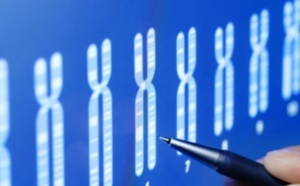 Des chercheurs neutralisent le chromosome responsable de la trisomie 21