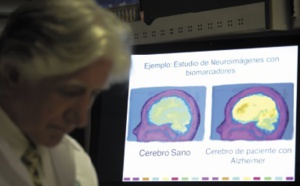 En Colombie, une "malédiction" pour guérir la planète d'Alzheimer