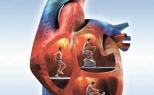 ​La Chine risque une épidémie de maladies cardiovasculaires