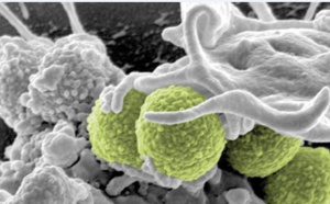 Contrôle des maladies transmissibles et émergentes