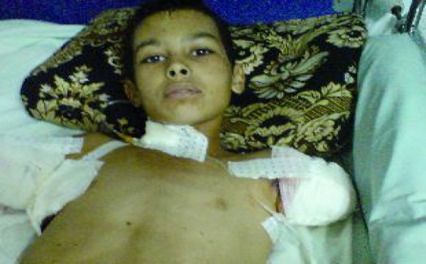 Drame à M’rirt : Un enfant perd ses bras par électrocution
