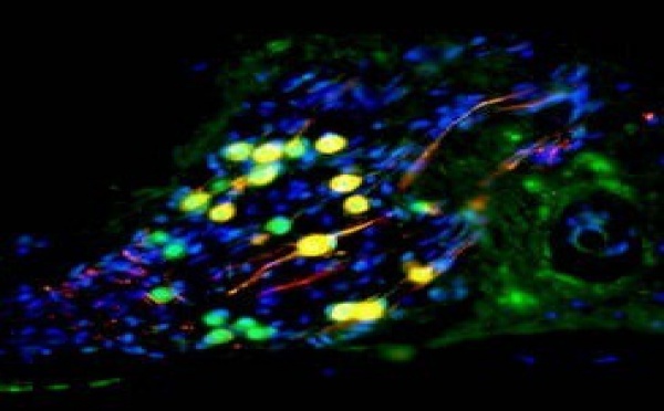 Des cellules souches pour améliorer l’ouïe