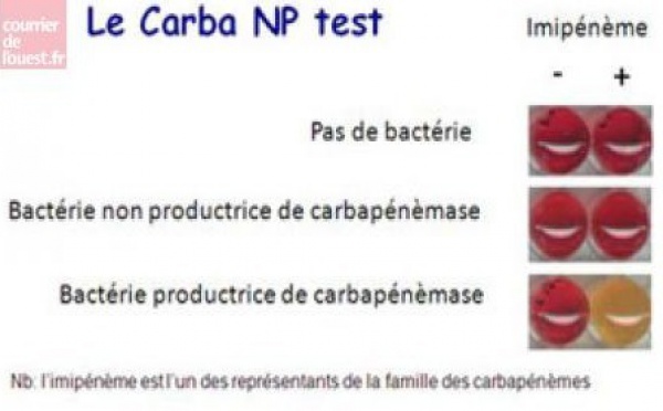 Deux tests rapides pour détecter les résistances aux antibiotiques