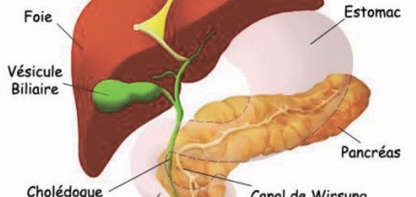 ​Une nouvelle technique de traitement  prometteur contre le cancer du pancréas