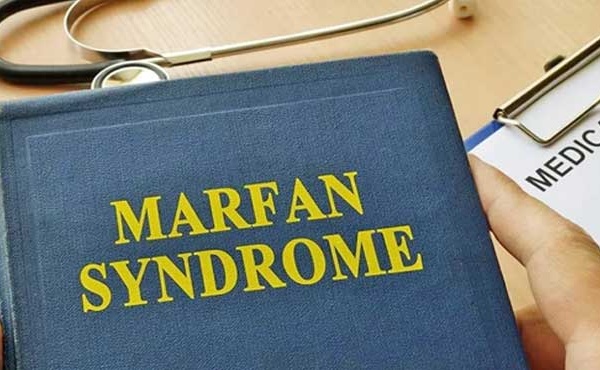 Le Syndrome de Marfan expliqué à Rabat