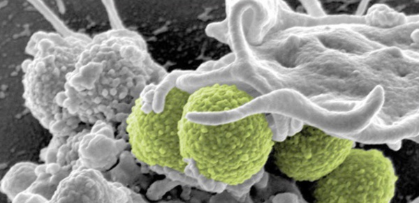 Contrôle des maladies transmissibles et émergentes