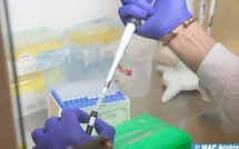 CDC-Afrique recommande le premier test PCR en temps réel pour la Mpox fabriqué localement au Maroc